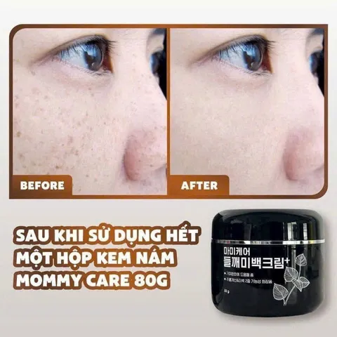 KEM NÁM MOMMY CARE PERILLA WHITENING CARE 80g