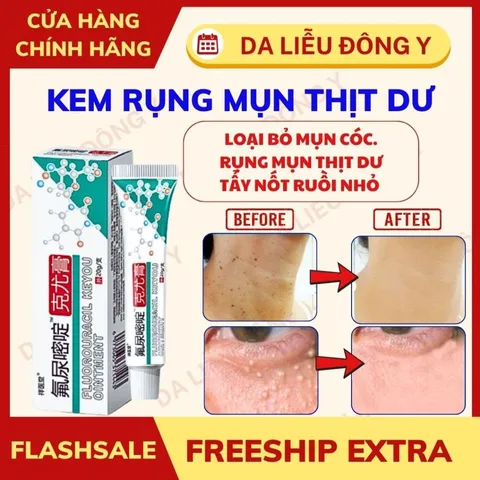 Kem Rụng Mụn Thịt Dư Keyou Date Xa NK