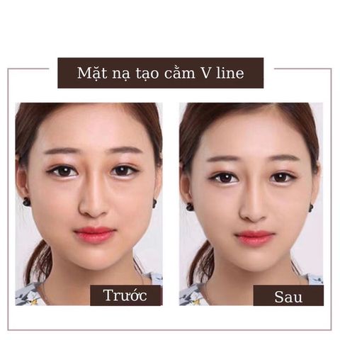 Combo 10 Mặt nạ định hình cằm V-line, tạo mặt Vline, Mặt Nạ Nâng Cơ, giảm mỡ nọng cằm (mặt nạ xài 1 lần)