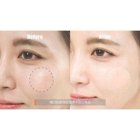 Serum Trắng Sáng Da, Cấp Ẩm, Chống Lão Hóa Vitamin C Serum 561 100ml