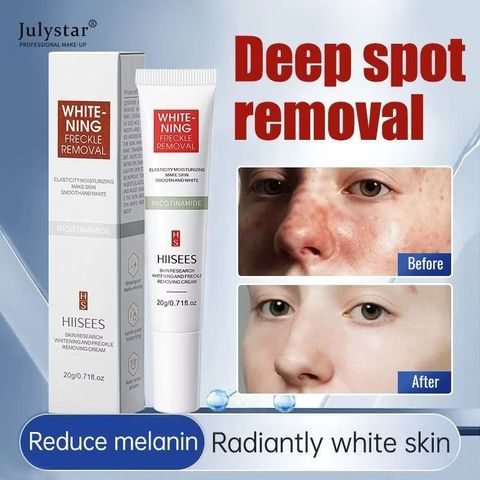 Kem bôi nám HIISEES dưỡng ẩm trắng da, mờ thâm nám, tàn nhang WHITE NING