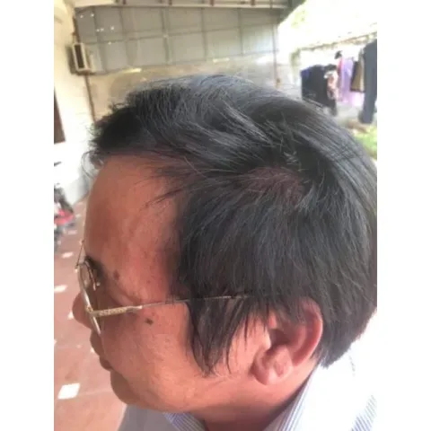 COMBO 10 gói Gội Là Đen Sâm