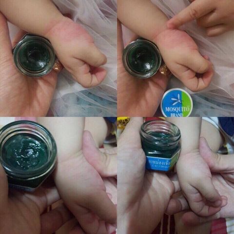 Dầu thoa giảm muỗi đốt, côn trùng cắn, bong gân Green Balm Mosquito