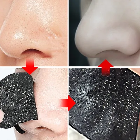 HOT 1 Mặt tấm dán Lột Mụn Đầu Đen rửa cho sạch Sâu se khít Lỗ Chân Lông