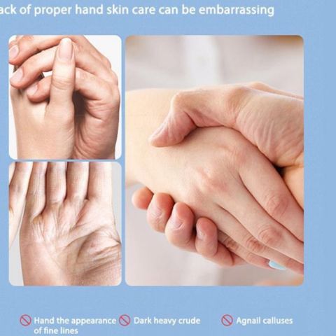 HOT Serum ORANOT giữ ẩm Làm Mềm Da Tay thời thượng 30g