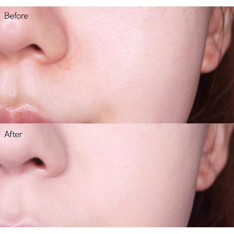 Serum trẻ hoá da , se khít lỗ chân lông Advanced 100ml