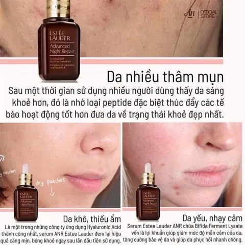 Tinh Chất Chống Lão Hóa & Phục Hồi Da Estee Lauder Advanced Night Repair 100ml Giảm nếp nhăn, Tăng đàn hồi, Đều màu