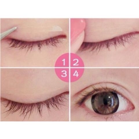 Dán mí chỉ Strip 80 sợi