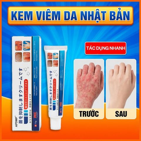 Kem Bôi Da NHẬT BẢN Dứt Điểm Viêm Da Cơ Địa Nấm Ngứa Ghẻ Nước Cực Kì Hiệu Quả