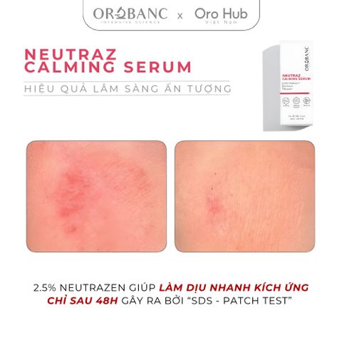 Tinh Chất Orobanc Làm Dịu Da, Giảm Đỏ, Phục Hồi - NeutraZ Calming Serum 30ml