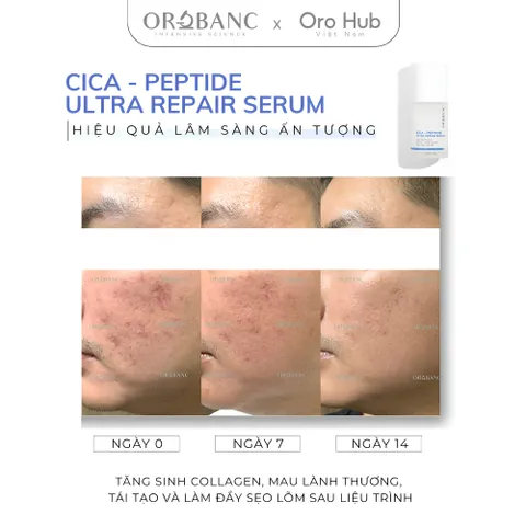 Tinh Chất Orobanc Phục Hồi, Tái Tạo Chuyên Sâu - Cica Peptide Ultra Repair Ampoule Serum 30ml