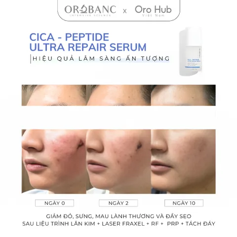Tinh Chất Orobanc Phục Hồi, Tái Tạo Chuyên Sâu - Cica Peptide Ultra Repair Ampoule Serum 30ml
