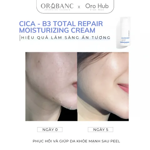 Kem Orobanc Dưỡng Ẩm, Làm Dịu Và Phục Hồi - Cica B3 Total Repair Moisturizing Cream 30g