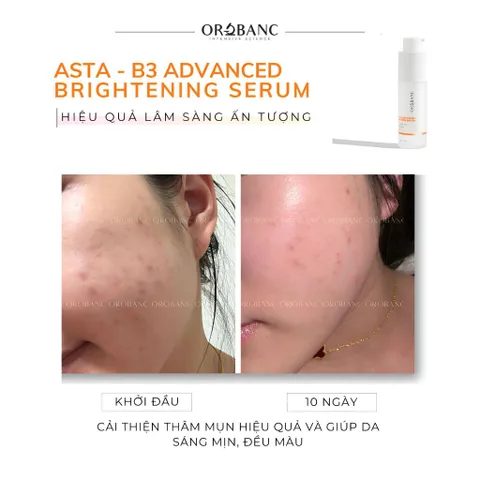 Combo Orobanc Dưỡng Sáng, Mờ Thâm, Ẩm Mịn Phục Hồi Da - Cica Peptide Serum 30ml + Asta B3 Serum 30ml