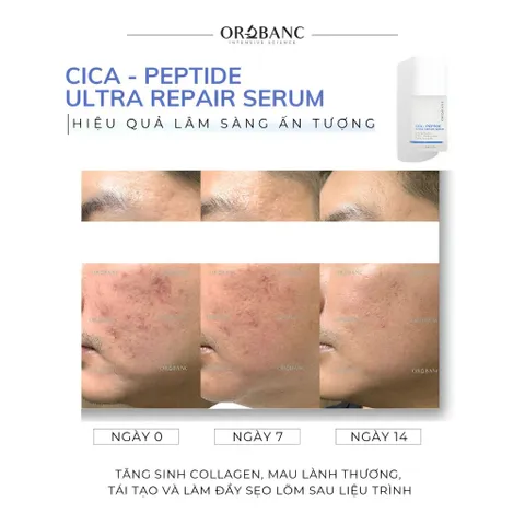 Combo Orobanc Dưỡng Sáng, Mờ Thâm, Ẩm Mịn Phục Hồi Da - Cica Peptide Serum 30ml + Asta B3 Serum 30ml