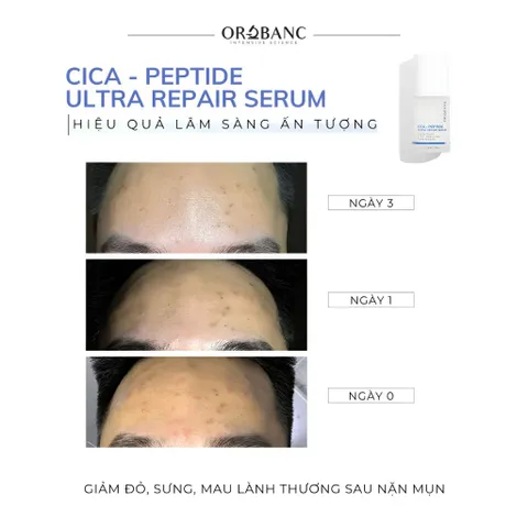 Combo Orobanc Dưỡng Sáng, Mờ Thâm, Ẩm Mịn Phục Hồi Da - Cica Peptide Serum 30ml + Asta B3 Serum 30ml