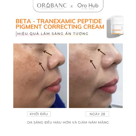 Kem Orobanc Dưỡng Sáng Da, Giảm Đốm Nâu Mờ Nám - Beta Tranexamic Peptide Pigment Correcting Cream 30g