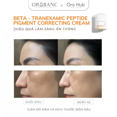 Kem Orobanc Dưỡng Sáng Da, Giảm Đốm Nâu Mờ Nám - Beta Tranexamic Peptide Pigment Correcting Cream 30g