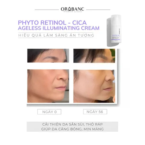 Combo Orobanc Trẻ Hoá Căng Mịn Mờ Nếp Nhăn - Ectoin B5 Serum 30ml - Phyto Retinol Cream 30gr