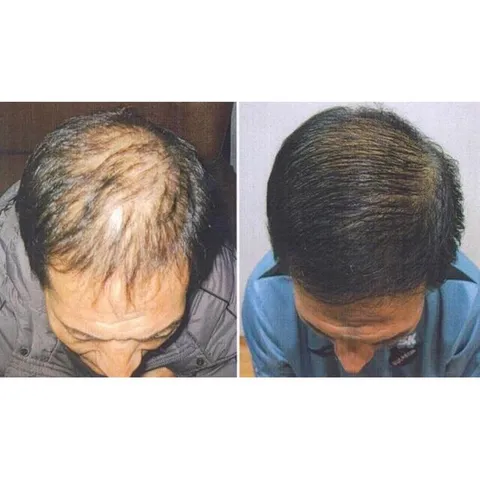 TINH DẦU BƯỞI GIẢM RỤNG KÍCH THÍCH MỌC TÓC MƯỢT TÓC 759952
