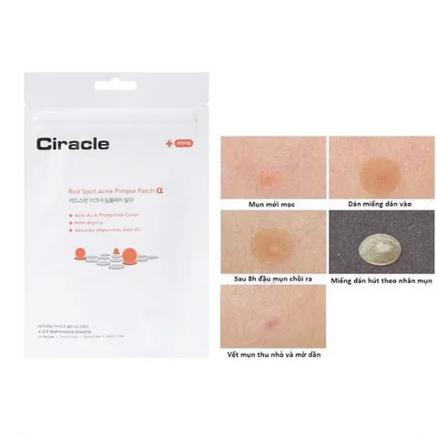 24 miếng] Miếng Dán Mụn Giúp Làm Dịu Và Hút Dịch Mủ Ciracle Red Spot Acne Pimple Patch 759976