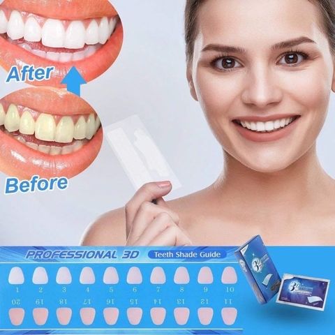 Combo 5 miếng dán trắng răng 3D tiện lợi an toàn 760209