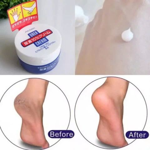 Kem hỗ trợ giảm nứt nẻ tay, gót chân Shiseido Urea Cream hộp 100g ,cung cấp độ ẩm cần thiết làm mềm da, cải thiện tình trạng bong tróc