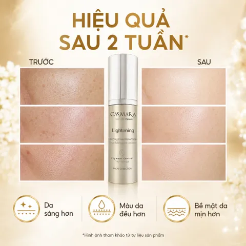 Casmara Lightening Serum 30ml Mờ Thâm Nám Sáng Da Đều Màu Hỗ Trợ Giảm Đốm Nâu Thâm Mụn