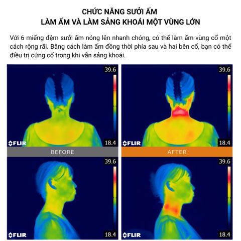 MÁY MASSAGE CỔ VAI GÁY MYTREX DR HEAT NECK