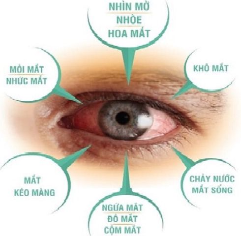 Viên uống bổ mắt, cải thiện thị giác Q&P Kowa Nhật Bản , sản phẩm lý tưởng dành cho những người có thị lực kém, tật khúc xạ, cận thị