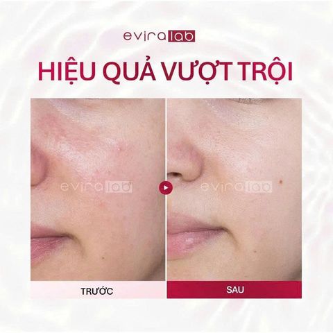 Kem Dưỡng Trắng Da Mờ Nám EVIRALAB MELA LIGHT CREAM 50ml [hàng nhập khẩu]