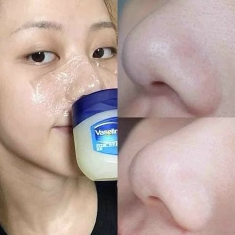 ✨ Vaseline Pure Petroleum Jelly Mềm Da, Dưỡng Ẩm Chuyên Sâu Chính Hãng 100ml
