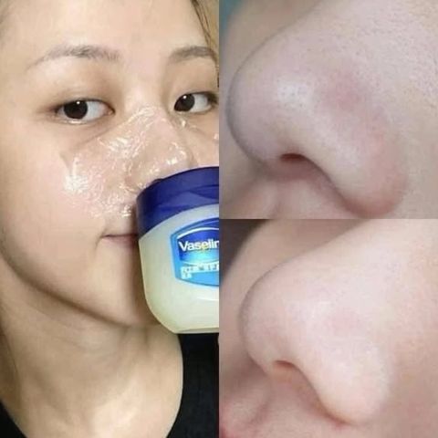 Vaseline Pure Petroleum Jelly 100ml dưỡng ẩm mềm da, giá tốt! 💰✨