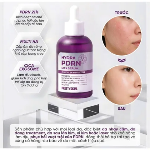 SERUM PHỤC HỒI CHUYÊN SÂU PRETTYSKIN HYDRA PDRN MAX CLINIC