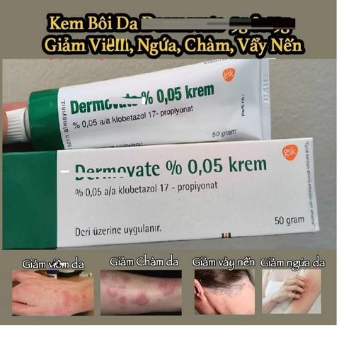 Dermo vate cream kem dưỡng da vẩy nến chàm da viêm da ngứa tub 50g