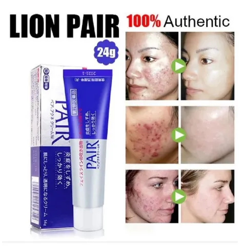 Kem  Mụn Pair Nhật Bản 14g
