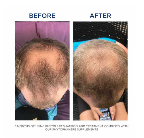 Viên Uống Dưỡng Tóc & Móng Phyto Phytophanere Hair & Nails - Hỗ Trợ Tóc Dày Khỏe, Móng Chắc Đẹp - 120 Viên Thực Phẩm Chức NăngViên Uống Dưỡng Tóc & Móng Phyto Phytophanere Hair & Nails - Hỗ Trợ Tóc Dà