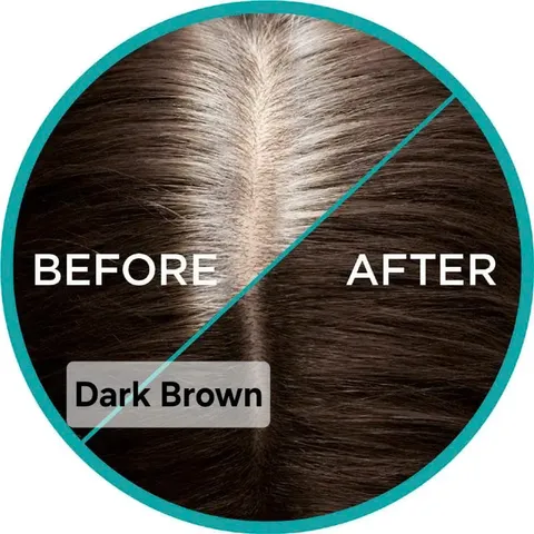 Xịt Phủ Chân Tóc L'Oréal Paris Magic Retouch Hỗ Trợ Che Tóc Bạc