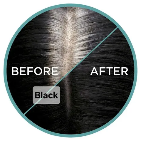 Xịt Che Chân Tóc Mọc Lại L'Oréal Paris Magic Retouch 75ml