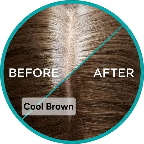 Xịt Che Phủ Chân Tóc L'Oréal Paris Magic Retouch Nhanh Gọn