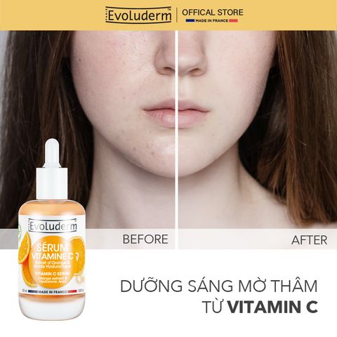 Tinh chất serum dưỡng ẩm, chăm sóc da Evoluderm 30ml