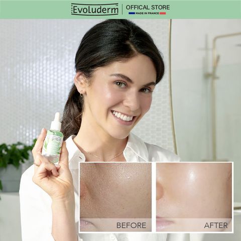 Tinh chất serum dưỡng ẩm, chăm sóc da Evoluderm 30ml