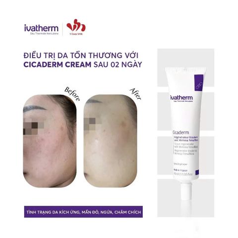  Ivatherm Cicaderm Cream-kem tái tạo lá chắn  Phục Hồi Da 