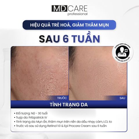 Kem Dưỡng Tái Tạo Và Cải Thiện Nếp Nhăn MD CARE Pro-Retinol 1.0 chai 30ml [hàng công ty]