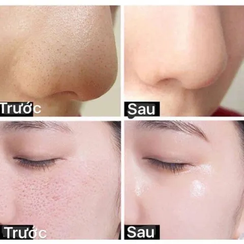Kem/Serum Retinol K Lady Care Repair Hàn Quốc Kem Dưỡng Da Giúp Trẻ Hóa 30ml