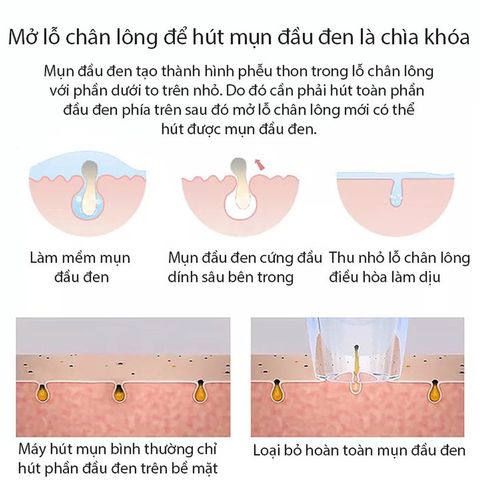 Máy hút mụn đầu đen mini cầm tay, dụng cụ tiện lợi chăm sóc da mặt