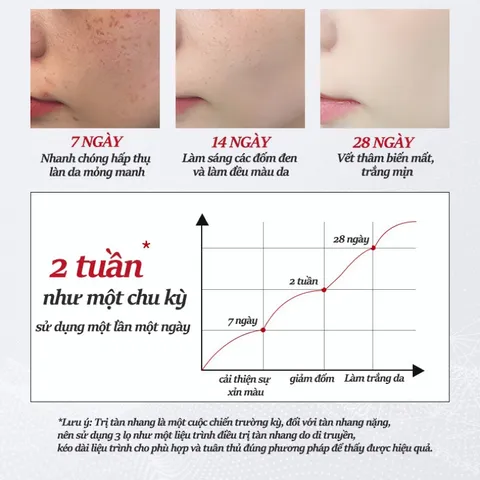 Kem trắng da và xóa tàn nhang Kem nám tàn nhang 20g kem dưỡng trắng da mặt Hiệu quả làm mờ thâm nám tàn nhang