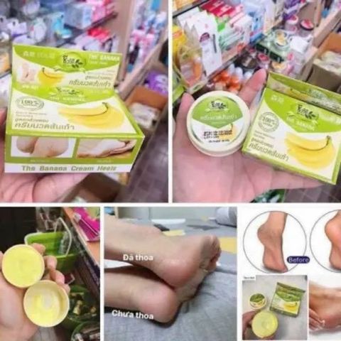 Kem NỨT GÓT CHÂN CHUỐI thái lan