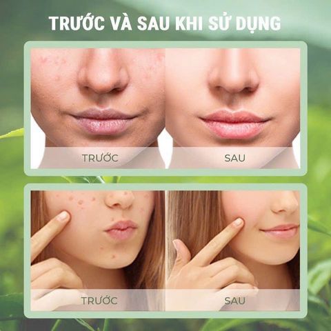 Mặt nạ trà xanh dạng lăn GREEN MASK STICK, Thanh lăn mặt nạ trà xanh Green mask stick - Cam Kết Chính hãng