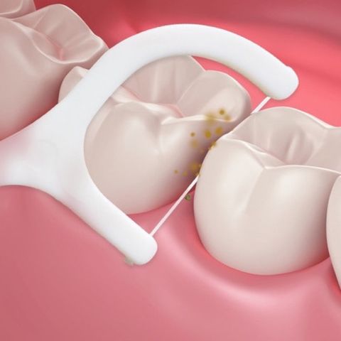 Combo 2 Hộp 50 Tăm Chỉ nha khoa bảo vệ răng miệng chống sâu răng, tăm chỉ nha khoa 777009
